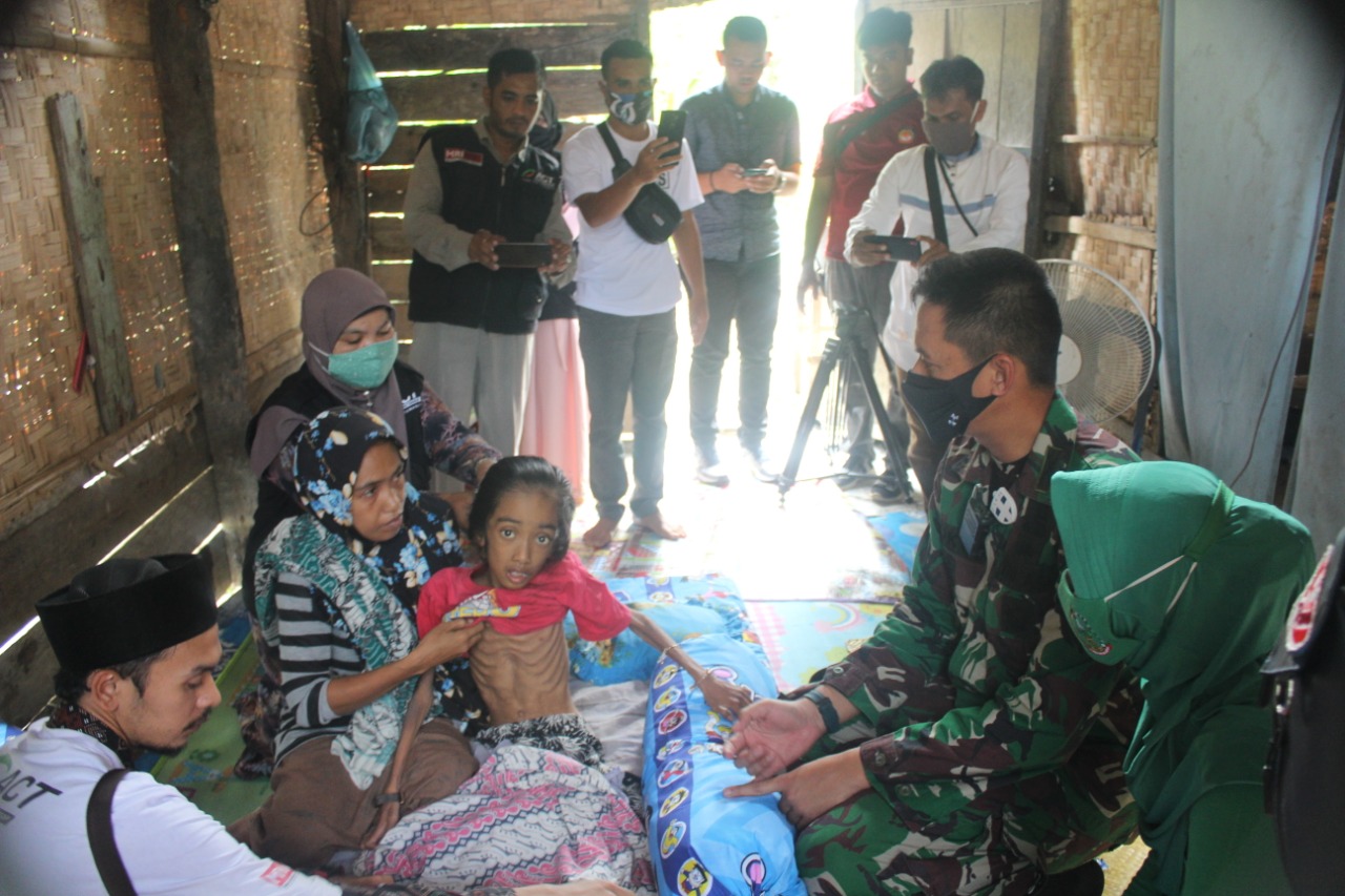 Dandim 0103/Aceh Utara Kunjungi Putri Aura Penderita Tipes Akut